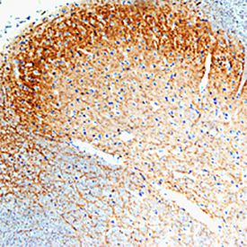 GFR alpha ‑1/GDNF R alpha ‑1 was detected in perfusion fixed frozen sections of rat spinal cord using Goat Anti-Rat GFR alpha ‑1/GDNF R alpha ‑1 Antigen Affinity-purified Polyclonal Antibody (Catalog # AF560) at 15 µg/mL overnight at 4 °C. Tissue was stained using the Anti-Goat HRP-DAB Cell & Tissue Staining Kit (brown; Catalog # CTS008) and counterstained with hematoxylin (blue). Specific staining was localized to spinal cord dorsal horn. View our protocol for Chromogenic IHC Staining of Frozen Tissue Sections.