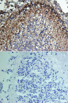 VCAM‑1/CD106 was detected in immersion fixed frozen sections of mouse embryo using Goat Anti-Mouse VCAM‑1/CD106 Antigen Affinity-purified Polyclonal Antibody (Catalog # AF643) at 15 µg/mL overnight at 4 °C. Tissue was stained using the Anti-Goat HRP-DAB Cell & Tissue Staining Kit (brown; Catalog # CTS008) and counterstained with hematoxylin (blue). Lower panel shows a lack of labeling if primary antibodies are omitted and tissue is stained only with secondary antibody followed by incubation with detection reagents. View our protocol for Chromogenic IHC Staining of Frozen Tissue Sections.