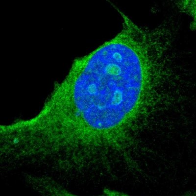 Immunocytochemistry/Immunofluorescence: PGRMC1 Antibody [NBP1-83220] - Immunofluorescent staining of human cell line U-251 MG shows localization to nucleoli & endoplasmic reticulum.