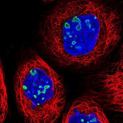 Immunocytochemistry/Immunofluorescence: RSL1D1 Antibody [NBP2-13269] - Staining of human cell line A-431 shows positivity in nucleoli.