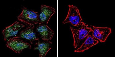 Immunocytochemistry/Immunofluorescence: NFAT5 Antibody [NB120-3446] - Analysis of NFAT5 in HeLa Cells. Cells were grown on chamber slides and fixed with formaldehyde prior to staining. Cells were probed without (control) or with a NFAT5 polyclonal antibody at a dilution of 1:20 overnight at 4C, washed with PBS and incubated with a DyLight-488 conjugated secondary antibody. NFAT5 staining (green), F-Actin staining with Phalloidin (red) and nuclei with DAPI (blue) is shown.
