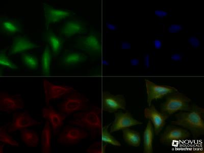 Immunocytochemistry/Immunofluorescence: TLR4 Antibody [NBP2-24821] - U2OS cells were fixed for 10 minutes using 10% formalin and then permeabilized for 5 minutes using 1X TBS + 0.5% Triton-X100. The cells were incubated with anti-TLR4 [NBP2-24821] at a 1:50 dilution overnight at 4C and detected with an anti-rabbit Dylight 488 (Green) at a 1:500 dilution. Alpha tubulin (DM1A) NB100-690 was used as a co-stain at a 1:1000 dilution and detected with an anti-mouse Dylight 550 (Red) at a 1:500 dilution. Nuclei were counterstained with DAPI (Blue). Cells were imaged using a 40X objective.