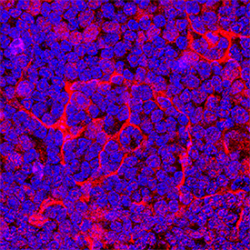 CCL11/Eotaxin was detected in perfusion fixed frozen sections of mouse thymus using Goat Anti-Mouse CCL11/Eotaxin Antigen Affinity-purified Polyclonal Antibody (Catalog # AF-420-NA) at 5 µg/mL overnight at 4 °C. Tissue was stained using the NorthernLights™ 557-conjugated Anti-Goat IgG Secondary Antibody (red; Catalog # NL001) and counterstained with DAPI (blue). Specific staining was localized to cytoplasm. View our protocol for Fluorescent IHC Staining of Frozen Tissue Sections.