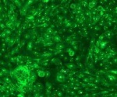 Immunocytochemistry/Immunofluorescence: Langerin/CD207 Antibody (808E10.01) [DDX0360P-100] - Analysis of Alexa Fluor (R) 488 conjugate of DDX0360P-100. Staining of Langerin-transfected CHO cells.