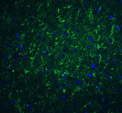 Immunocytochemistry/Immunofluorescence: PD-L2/B7-DC/PDCD1LG2 Antibody [NBP1-76770] - Staining of PD-L2 in mouse brain tissue with PD-L2 antibody at 20 ug/ml.