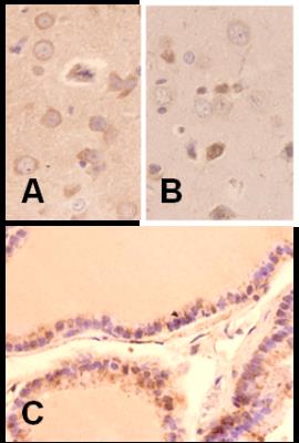 Immunohistochemistry-Paraffin: Melatonin Receptor 1B Antibody [NLS932] - Melatonin receptor type 1 B (MTR1B) in rat tissues fixed in paraformaldehyde and embedded in paraffin. A,B-brain, C-prostate. Image from verified customer review.