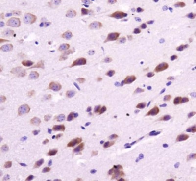 Immunohistochemistry: Melatonin Receptor 1B Antibody [NLS932] - Staining of Mouse Brain.