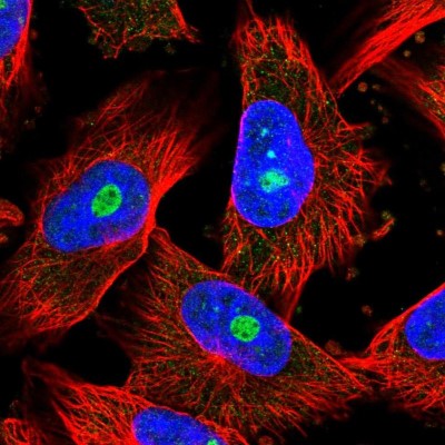 Immunocytochemistry/Immunofluorescence: CRBN Antibody [NBP1-91810] - Immunofluorescent staining of human cell line U-251 MG shows localization to nucleoli.