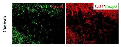 Immunocytochemistry/Immunofluorescence: FOXP3 Antibody [NB600-245] - Incubated only with CD4 and no Foxp3
