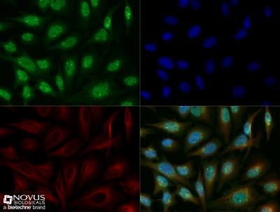 Immunocytochemistry/Immunofluorescence: Lysine (K)-specific Demethylase 6B/KDM6B/JMJD3 Antibody [NBP1-06640] - HeLa cells were fixed for 10 minutes using 10% formalin and then permeabilized for 5 minutes using 1X TBS + 0.5% Triton-X100. The cells were incubated with anti-JMJD3 [NBP1-06640] at a 1:200 dilution overnight at 4C and detected with an anti-rabbit Dylight 488 (Green) at a 1:500 dilution. Alpha tubulin (DM1A) [NB100-690] was used as a co-stain at a 1:1000 dilution and detected with an anti-mouse Dylight 550 (Red) at a 1:500 dilution. Nuclei were counterstained with DAPI (Blue). Cells were imaged using a 40X objective.