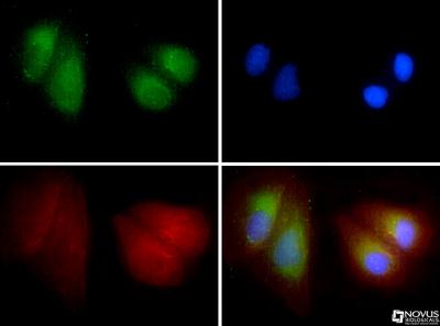 Immunocytochemistry/Immunofluorescence: SR-BII Antibody [NB400-102] - SR-BII antibody was tested in U2OS cells with FITC (green). Nuclei and alpha-tubulin were counterstained with Dapi (blue) and Dylight 550 (red).
