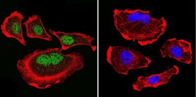 Immunocytochemistry/Immunofluorescence: Parvalbumin Antibody [NB120-11427] - Analysis of Parvalbumin using Anti-Parvalbumin Polyclonal Antibody shows staining in U251 Cells. Parvalbumin staining (green), F-Actin staining with Phalloidin (red) and nuclei with DAPI (blue) is shown. Cells were grown on chamber slides and fixed with formaldehyde prior to staining. Cells were probed without (control) or with or an antibody recognizing Parvalbumin at a dilution of 1:200 over night at 4C, washed with PBS and incubated with a DyLight-488 conjugated.