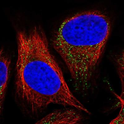Immunocytochemistry/Immunofluorescence: MARVELD3 Antibody [NBP1-92099] - Staining of human cell line U-2 OS shows positivity in vesicles.