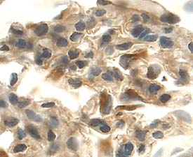 VEGF164 was detected in perfusion fixed frozen sections of rat kidney using 15 µg/mL Goat Anti-Rat VEGF164 Antigen Affinity-purified Polyclonal Antibody (Catalog # AF564) overnight at 4 °C. Tissue was stained with the Anti-Goat HRP-DAB Cell & Tissue Staining Kit (brown; Catalog # CTS008) and counterstained with hematoxylin (blue). View our protocol for Chromogenic IHC Staining of Frozen Tissue Sections.