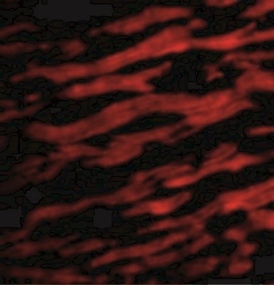 Immunofluorescence: TIRAP (TLR2 and TLR4) Antibody [NBP1-77226] - Immunofluorescence of TIRAP in Human Heart cells with TIRAP antibody at 20 ug/mL.