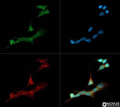 Immunocytochemistry/Immunofluorescence: Aromatase Antibody [NB100-1596] - Aromatase antibody was tested in SH-SY-5Y cells with Dylight 488 (green). Nuclei and alpha-tubulin were counterstained with DAPI (blue) and Dylight 550 (red).