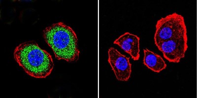 Immunocytochemistry/Immunofluorescence: PMCA1 Antibody (5F10) [NB300-578] - Analysis of PMCA ATPase using Anti-PMCA ATPase Monoclonal Antibody (5F10) shows staining in U251 Cells. PMCA ATPase staining (green), F-Actin staining with Phalloidin (red) and nuclei with DAPI (blue) is shown. Cells were grown on chamber slides and fixed with formaldehyde prior to staining. Cells were probed without (control) or with or an antibody recognizing PMCA ATPase at a dilution of 1:200 over night at 4C, washed with PBS and incubated with a DyLight-488 conjugated.