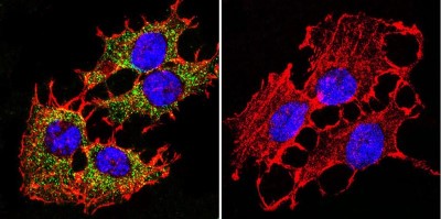 Immunocytochemistry/Immunofluorescence: PMCA1 Antibody (5F10) [NB300-578] - Analysis of PMCA ATPase using Anti-PMCA ATPase Monoclonal Antibody (5F10) shows staining in C6 Cells. PMCA ATPase staining (green), F-Actin staining with Phalloidin (red) and nuclei with DAPI (blue) is shown. Cells were grown on chamber slides and fixed with formaldehyde prior to staining. Cells were probed without (control) or with or an antibody recognizing PMCA ATPase at a dilution of 1:200 over night at 4C, washed with PBS and incubated with a DyLight-488 conjugated.