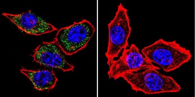 Immunocytochemistry/Immunofluorescence: PMCA1 Antibody (5F10) [NB300-578] - Analysis of PMCA ATPase using Anti-PMCA ATPase Monoclonal Antibody (5F10) shows staining in Hela Cells. PMCA ATPase staining (green), F-Actin staining with Phalloidin (red) and nuclei with DAPI (blue) is shown. Cells were grown on chamber slides and fixed with formaldehyde prior to staining. Cells were probed without (control) or with or an antibody recognizing PMCA ATPase at a dilution of 1:100 over night at 4C, washed with PBS and incubated with a DyLight-488 conjugated.