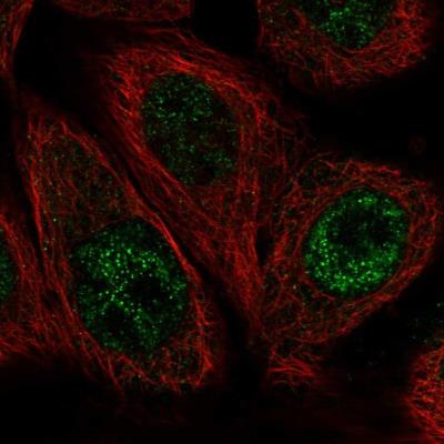 Immunocytochemistry/Immunofluorescence: CPXCR1 Antibody [NBP1-85396] - Staining of human cell line A-431 shows positivity in nucleus but not nucleoli.