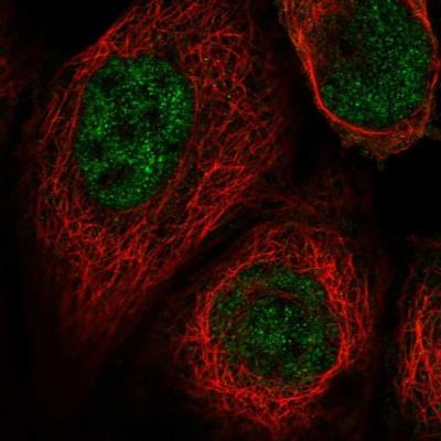 Immunocytochemistry/Immunofluorescence: FAM63A Antibody [NBP1-83759] - Staining of human cell line A-431 shows positivity in nucleus but not nucleoli.