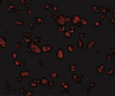 Immunocytochemistry/Immunofluorescence: IRGC Antibody [NBP1-77363] - Immunofluorescence of IRGCa in A20 cells with IRGCa antibody at 20 ug/mL.