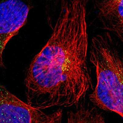 Immunocytochemistry/Immunofluorescence: ST6GALNAC4 Antibody [NBP1-80752] - Staining of human cell line U-2 OS shows positivity in golgi apparatus.