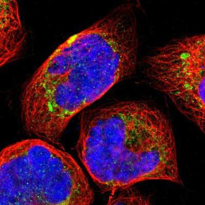 Immunocytochemistry/Immunofluorescence: GLT8D1 Antibody [NBP1-90872] - Staining of human cell line A-431 shows positivity in mitochondria.
