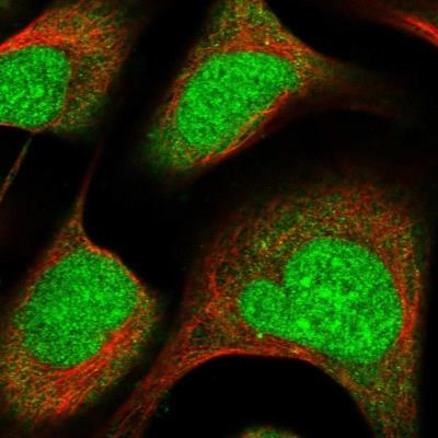 Immunocytochemistry/Immunofluorescence: ZNF195 Antibody [NBP1-86338] - Staining of human cell line U-2 OS shows positivity in nucleus & cytoplasm.
