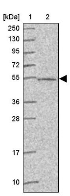 Western Blot: C4orf29 Antibody [NBP2-30555] - Lane 1: Marker [kDa] 250, 130, 95, 72, 55, 36, 28, 17, 10<br/>Lane 2: Human cell line RT-4