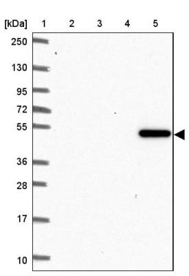 Western Blot: Glycine Receptor alpha 1 + alpha 2 Antibody [NBP2-31828] - Lane 1: Marker [kDa] 250, 130, 95, 72, 55, 36, 28, 17, 10<br/>Lane 2: Human cell line RT-4<br/>Lane 3: Human cell line U-251MG sp<br/>Lane 4: Human plasma (IgG/HSA depleted)<br/>Lane 5: Human liver tissue