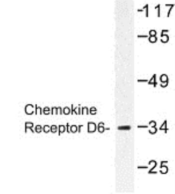 Western Blot: CC Chemokine Receptor D6 Antibody [NBP1-00751] - Western blot (WB) analysis of  CC Chemokine Receptor D6 (S383) antibody in extracts from HepG2