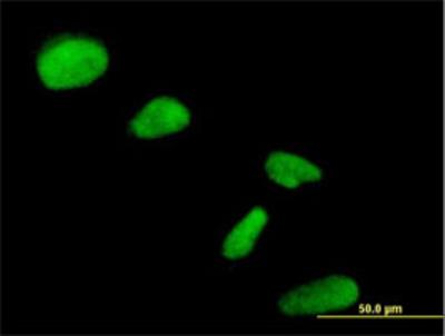 Immunofluorescence: NIP30 Antibody [H00080011-B01] - Immunofluorescence of purified MaxPab antibody to NIP30 on HeLa cell. [antibody concentration 10 ug/ml]
