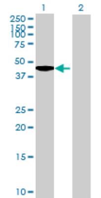 Western Blot: LCORL Antibody [H00254251-B01] - analysis of MLR1 expression in transfected 293T cell line by MLR1 MaxPab polyclonal antibody (B01). Lane 1: MLR1 transfected lysate (35.40 KDa). Lane 2: Non-transfected lysate.