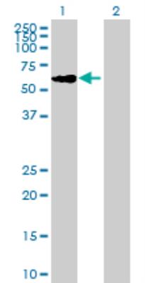 Western Blot: C9orf43 Antibody [H00257169-B01] - analysis of C9orf43 expression in transfected 293T cell line by C9orf43 MaxPab polyclonal antibody. Lane 1: C9orf43 transfected lysate (50.71 KDa). Lane 2: Non-transfected lysate.