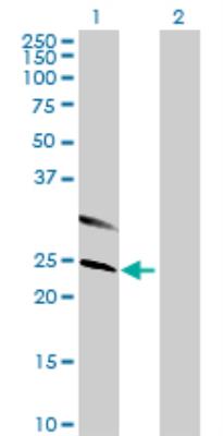 Western Blot: C7orf30 Antibody [H00115416-B01] - analysis of C7orf30 expression in transfected 293T cell line by C7orf30 MaxPab polyclonal antibody. Lane 1: C7orf30 transfected lysate (25.74 KDa). Lane 2: Non-transfected lysate.
