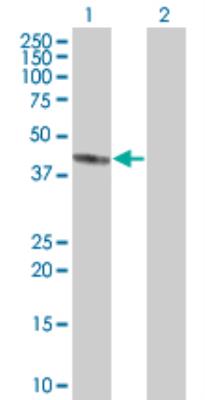 Western Blot: C2orf62 Antibody [H00375307-B01] - analysis of MGC50811 expression in transfected 293T cell line by MGC50811 MaxPab polyclonal antibody (B01). Lane 1: MGC50811 transfected lysate (43.90 KDa). Lane 2: Non-transfected lysate.
