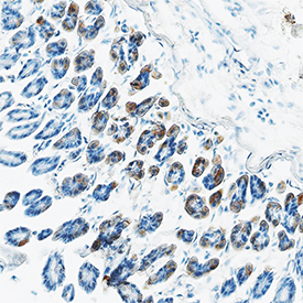 CCL11/Eotaxin was detected in perfusion fixed frozen sections of mouse colon using Goat Anti-Mouse CCL11/Eotaxin Biotinylated Antigen Affinity-purified Polyclonal Antibody (Catalog # BAF420) at 15 µg/mL overnight at 4 °C. Tissue was stained using the Anti-Goat HRP-DAB Cell & Tissue Staining Kit  (brown; Catalog # CTS008) and counterstained with hematoxylin (blue). Specific staining was localized to cytoplasm. View our protocol for Chromogenic IHC Staining of Frozen Tissue Sections.