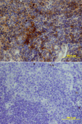 TACI/TNFRSF13B was detected in perfusion fixed frozen sections of mouse thymus using Goat Anti-Mouse TACI/TNFRSF13B Biotinylated Antigen Affinity-purified Polyclonal Antibody (Catalog # BAF1041) at 15 µg/mL overnight at 4 °C. Tissue was stained using the Anti-Goat HRP-DAB Cell & Tissue Staining Kit (brown; Catalog # CTS008) and counterstained with hematoxylin (blue). Lower panel shows a lack of labeling if primary antibodies are omitted and tissue is stained only with secondary antibody followed by incubation with detection reagents. View our protocol for Chromogenic IHC Staining of Frozen Tissue Sections.