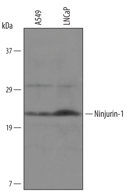 Western blot shows lysates of A549 human lung carcinoma cell line and LNCaP human prostate cancer cell line. PVDF membrane was probed with 1 µg/mL of Sheep Anti-Human Ninjurin-1 Biotinylated Antigen Affinity-purified Polyclonal Antibody (Catalog # BAF5105) followed by HRP-conjugated Anti-Sheep IgG Secondary Antibody (Catalog # HAF016). A specific band was detected for Ninjurin-1 at approximately XXX kDa (as indicated). This experiment was conducted under reducing conditions and using Immunoblot Buffer Group XXX.