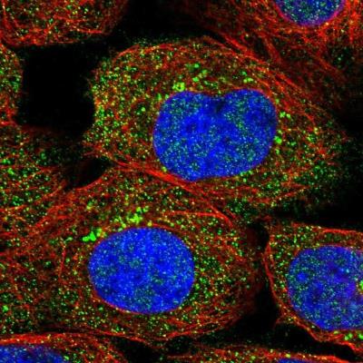 Immunocytochemistry/Immunofluorescence: RHBDF2 Antibody [NBP1-82126] - Staining of human cell line A-431 shows positivity in nucleus but not nucleoli.