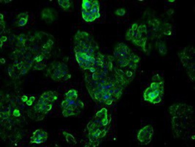Immunocytochemistry/Immunofluorescence: TTLL12 Antibody (7F11) [NBP2-02216] - Immunofluorescent staining of HepG2 cells using anti-TTLL12 mouse monoclonal antibody.