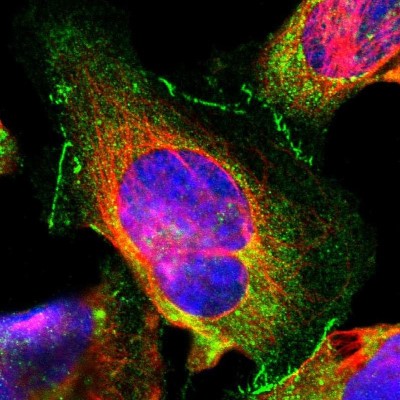 Immunocytochemistry/Immunofluorescence: Tight Junction Protein 1 Antibody [NBP1-85047] - Immunofluorescent staining of human cell line U-2 OS shows localization to cytosol & cell junctions.