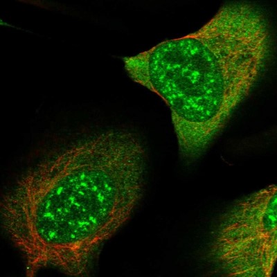 Immunocytochemistry/Immunofluorescence: SMC4 Antibody [NBP1-86635] - Immunofluorescent staining of human cell line U-2 OS shows localization to nuclear speckles & cytosol.