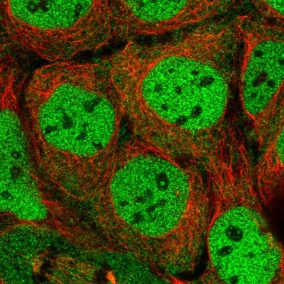 Immunocytochemistry/Immunofluorescence: SIK3 Antibody [NBP2-47278] - Immunofluorescent staining of human cell line CACO-2 shows localization to nucleoplasm.