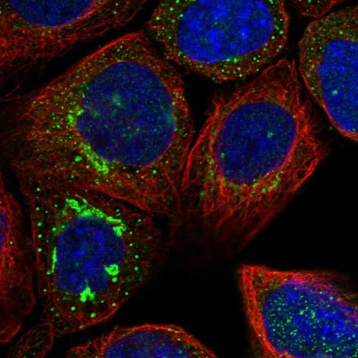 Immunocytochemistry/Immunofluorescence: ATP6V0A1 Antibody [NBP1-89342] - Immunofluorescent staining of human cell line A-431 shows localization to the Golgi apparatus & vesicles.