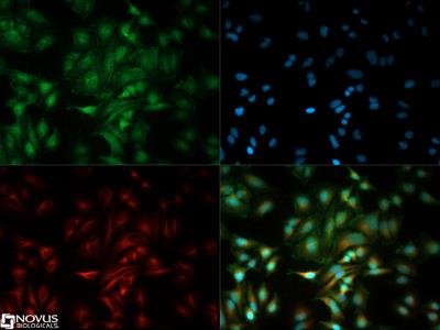 Immunocytochemistry/Immunofluorescence: PUMA Antibody [NB500-261] - The PUMA antibody was tested at a 1:20 dilution in HeLa cells against Dylight 488 (Green).  Alpha-tubulin and nuclei were counterstained against Dylight 550 (Red) and DAPI (Blue).