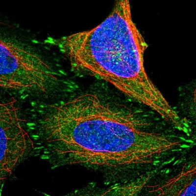 Immunocytochemistry/Immunofluorescence: Testin Antibody [NBP1-87987] - Immunofluorescent staining of human cell line SiHa shows localization to cytosol & focal adhesion sites.