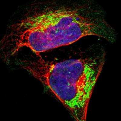 Immunocytochemistry/Immunofluorescence: ATPB Antibody [NBP1-90816] - Immunofluorescent staining of human cell line U-2 OS shows localization to mitochondria.