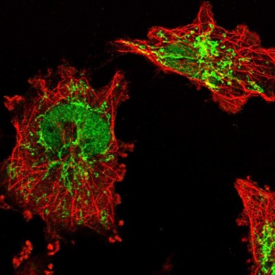 Immunocytochemistry/Immunofluorescence: BDH1 Antibody [NBP1-88673] - Immunofluorescent staining of human cell line U-251 MG shows localization to nucleoplasm & mitochondria.